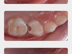 -新达口腔(华东理工大学店)