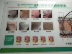 -成都军建医院·疤痕诊疗中心