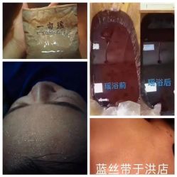 -蓝丝带产后恢复中心(于洪店)