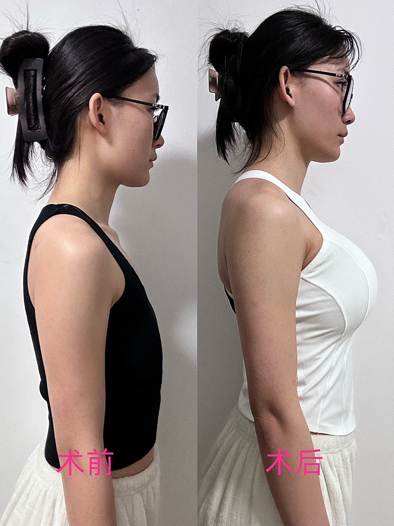 终于告别🐻平胸的尴尬!