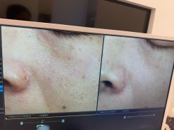 -苑苑vbeauty科技美容SPA