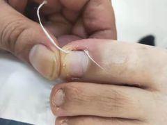 -新甲连锁灰指甲·甲沟炎·鸡眼(黑龙江路店)