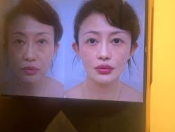 -Yestar杭州艺星医疗美容医院