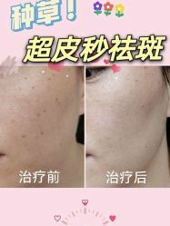 点击看大图 -Yestar杭州艺星医疗美容医院