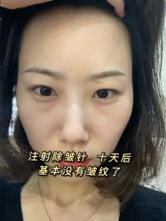 点击看大图 -天津时光诺颜·轻医美·轮廓抗衰中心