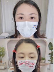 点击看大图 -Verywang半永久纹眉•仪器野生眉