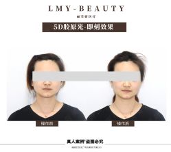 -丽美妍医疗美容·皮秒·立体分层抗衰