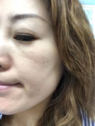 -针美汇欧邦医疗美容