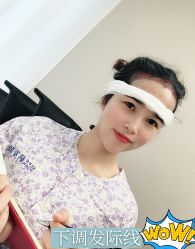 -大麦微针植发全国连锁