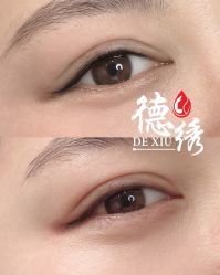 -德绣·机器野生眉发际线·美瞳线半永久
