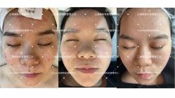 -Cream88颜皮肤管理中心