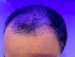 -熙朵美学植发·连锁品牌