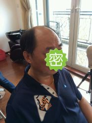 男发-髻尚坊增发补发织发假发定制