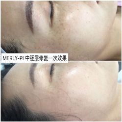 -MLP美丽派·问题肌疗愈中心