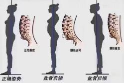 -卡莫瑜伽·普拉提