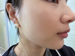 -长沙雅美医疗美容医院