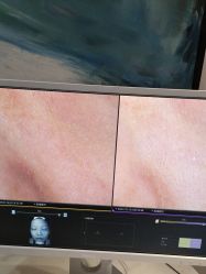 -苑苑vbeauty科技美容SPA
