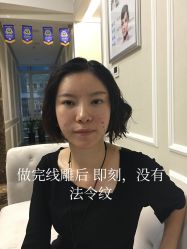 -北京米扬丽格医疗美容·联合丽格鼻整形中心