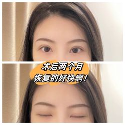 -素美医疗美容·西南眼鼻整形·修复基地