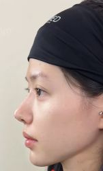 -杭州米兰柏羽医疗美容医院