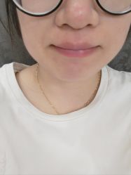 体验后-深圳阳光医疗美容医院·旗舰店