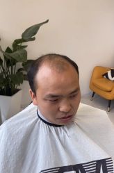 -发饰美男士增发补发假发定制店