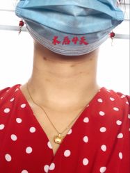 -大麦微针植发全国连锁