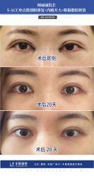 -丰联丽格医疗美容·联合丽格眼整形中心