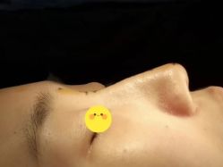 -脸博士医疗美容·眼鼻整形·抗衰中心
