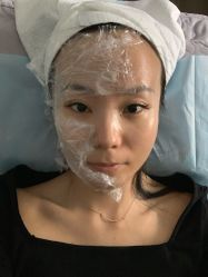 体验前-小忠丽格医美
