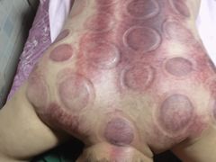 -沈师傅盲人按摩工作室(密三小区店)