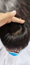 -发饰美男士增发补发假发定制店