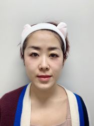 -八大处整形