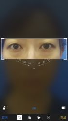 体验前-八大处整形