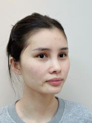 -深圳艺星医疗美容医院