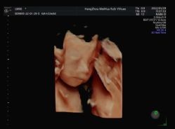 -杭州贝瑞斯美华妇儿医院·早孕·产检·儿科