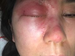 -北京熙仁医院眼科·近视手术专科