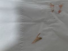 -世龙世家灰指甲鸡眼脚气甲沟炎跖疣护理(通州店)