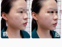 -修申骨雕小颜脊柱骨盆管理产后修复