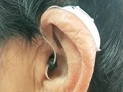 -自然之声助听器·呼吸机(保定清苑店)