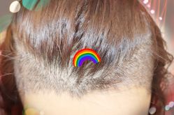 -大麦微针植发全国连锁