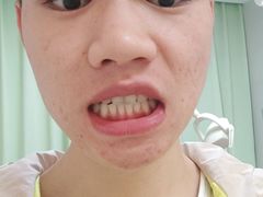 -团圆口腔·种植中心(锦江院区)