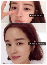 iphone_upload_pic-MIVI半永久纹眉机器野生眉纹唇