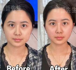 -颜和骨正&明星徒手小颜整骨