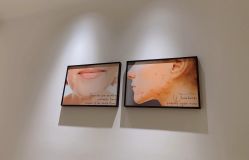 -紫御国际抗衰ZOE ANTI AGING