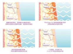点击看大图 -AURAS璈然科技护肤中心
