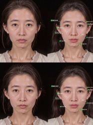 点击看大图 -Yestar艺星整形美容医院