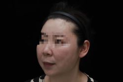 -上海漾颜医疗美容