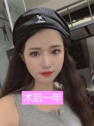-广州健丽·去眼袋医疗美容机构