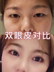 -长沙雅美医疗美容医院